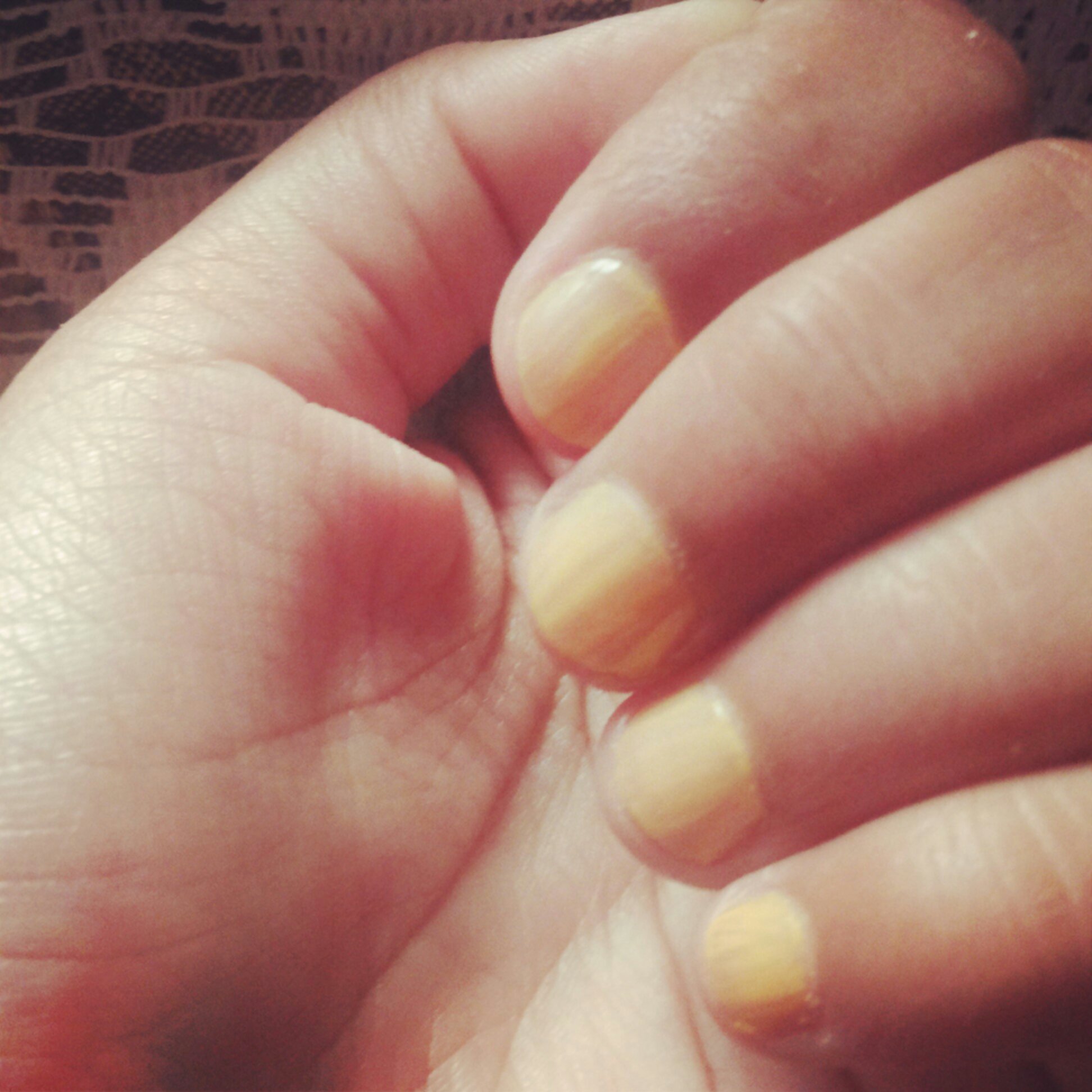 QUIZ TIME📌 What causes nails to turn yellow?🙋 . Comment below to let us  know⤵️ . 📢Tips: 1. Stained yellow by nail polish--Give your nails… |  Instagram